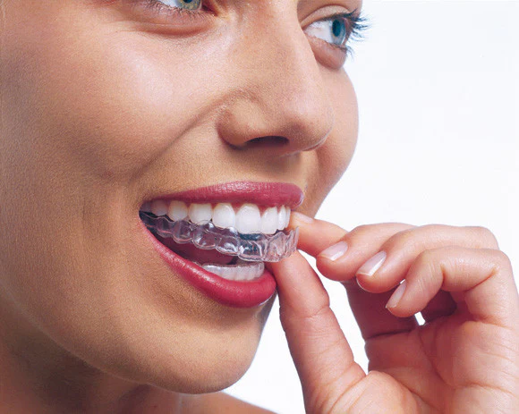 Smile With Absolute Confidence